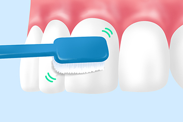 ブラッシング指導